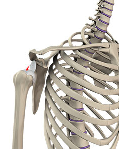 Shoulder Dislocations