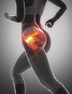 Hip Injuries