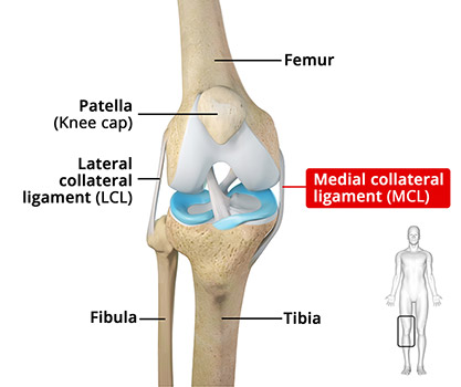 The Medial Collateral Ligament (MCL)