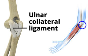 ulnar collateral ligament rehabilitation