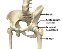 hip fracture